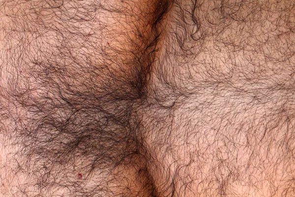 Hairy skin — Stock Photo, Image