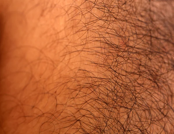 Hairy skin — Stock Photo, Image