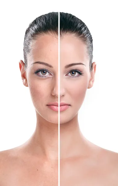 Antes e depois - pele — Fotografia de Stock