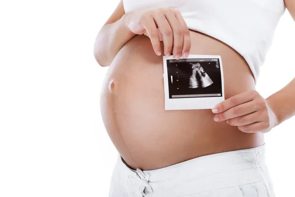 Kobieta trzyma zdjęcie USG brzucha w ciąży — Zdjęcie stockowe