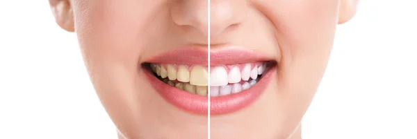 Healthy teeth and smile Royalty Free Stock Images