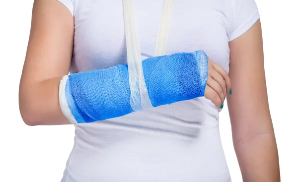 Patient with a cast on arm — Stock Photo, Image