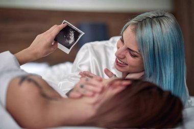 Mutlu lezbiyen çift birlikte hamileliğin mutluluğunu paylaşıyor.