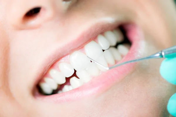 Czyszczenie zębów — Zdjęcie stockowe
