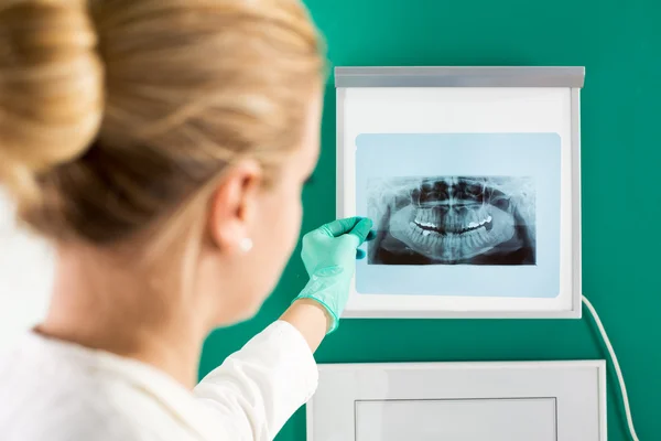 Dentist Doctor with x-ray image — Stock Photo, Image