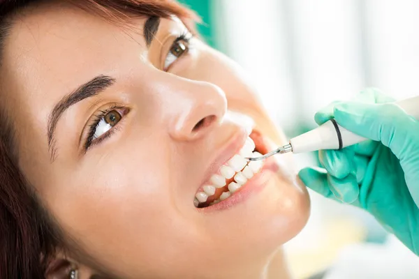 Tandheelkundige reiniging — Stockfoto