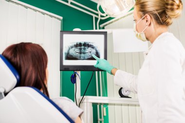 diş hekimi hastanın x-ray resim gösteriliyor