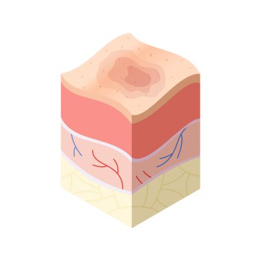 Cilt bakım konsepti. İnsan derisinin yatay katman yapısında kesit problemleri var. Anatomi çizim modeli