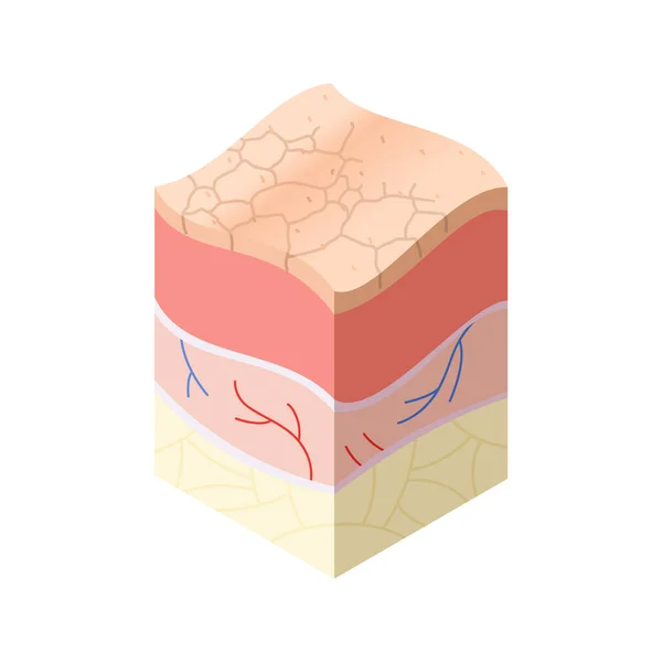 Concepto médico del cuidado de la piel. Problemas en la sección transversal de la estructura de capas horizontales de la piel humana. Modelo ilustrativo de anatomía — Vector de stock