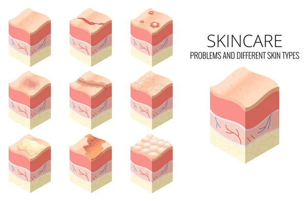 Sjukvårdskonceptet hudvård. Uppsättning problem av olika hudtyper i tvärsnitt av mänsklig hud horisontella lager struktur — Stock vektor