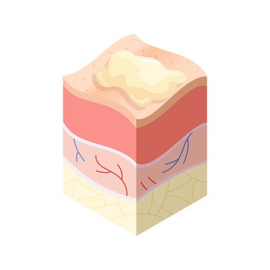 Cilt bakım konsepti. İnsan derisinin yatay katman yapısında kesit problemleri var. Anatomi çizim modeli