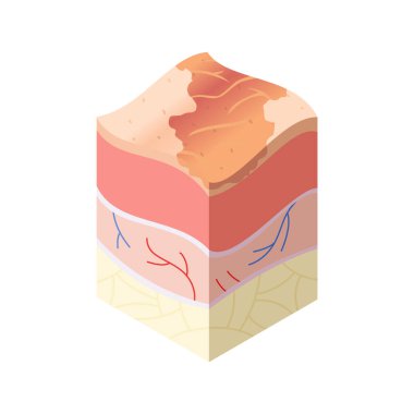 Cilt bakım konsepti. İnsan derisinin yatay katman yapısında kesit problemleri var. Anatomi çizim modeli