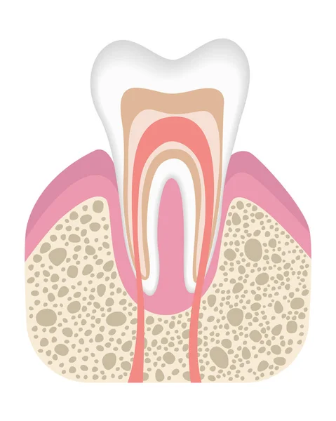 Dente saudável não está infectado com cárie. Estágio antes do desenvolvimento da cárie. Estrutura dos dentes em estilo plano. Dente com esmalte. Ilustração vetorial realista — Vetor de Stock