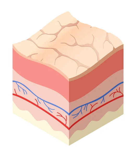 スキンケア医療の概念 ヒトの皮膚水平層構造の断面における問題 解剖学イラストモデル 皮膚の不健康な層 — ストックベクタ