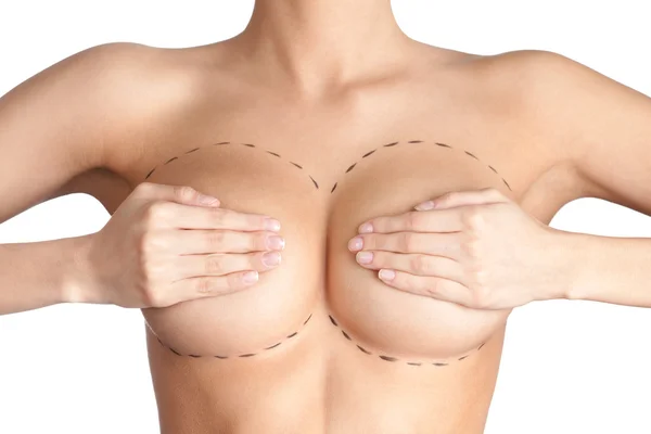 Boobs correctie. plastische chirurgie — Stockfoto