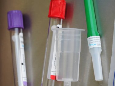 belarus,minsk,2021. Klinikteki masada analiz yapmak için renkli Vacu laboratuvar tüpleri.
