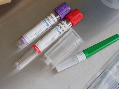 belarus,minsk,2021. Klinikteki masada analiz yapmak için renkli Vacu laboratuvar tüpleri.