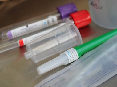 belarus,minsk,2021. Klinikteki masada analiz yapmak için renkli Vacu laboratuvar tüpleri.