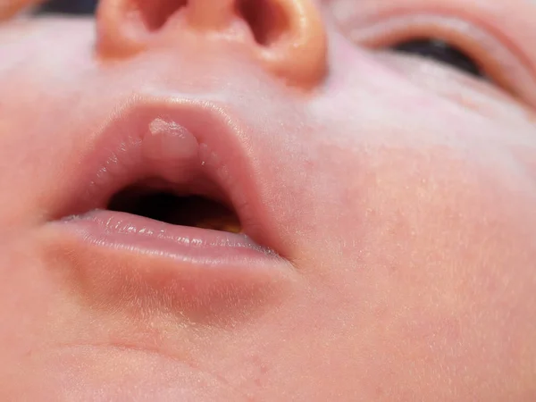 Callo Labio Superior Del Bebé Durante Lactancia —  Fotos de Stock