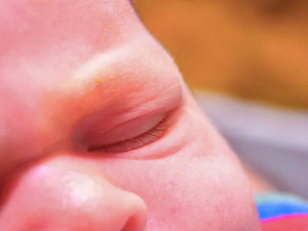 Conjuntivitis Ojo Bebé Recién Nacido —  Fotos de Stock