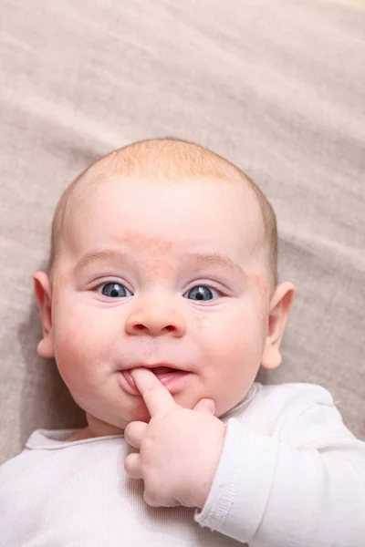 Retrato Bebé Recién Nacido Con Dedo Boca Cara Alergia —  Fotos de Stock