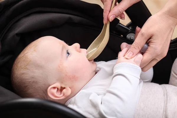 Mom Spoon Gives Medicine Newborn Baby Allergy Dermatitis Face — Stock Photo, Image