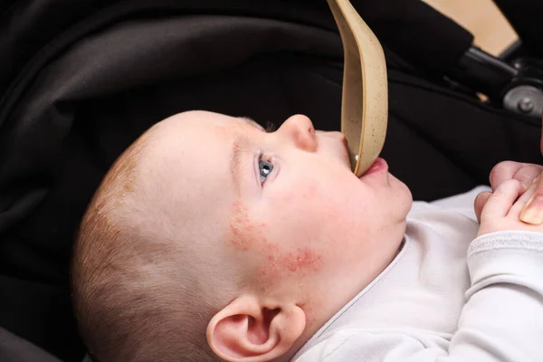 Mamma Från Sked Ger Medicin Till Nyfödd Baby Allergi Dermatit — Stockfoto