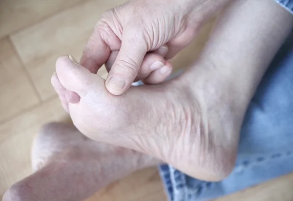 Man wrijven zijn atleten voet toestand — Stockfoto