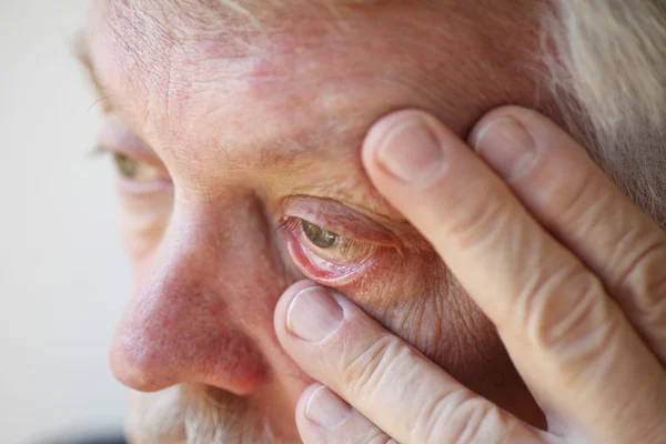 Hombre mayor cansado muestra párpado inferior — Foto de Stock