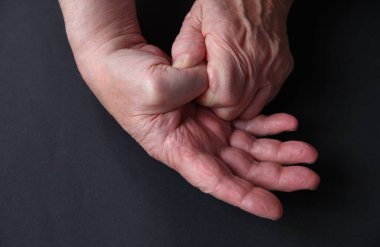 An older man has pain in a thumb joint