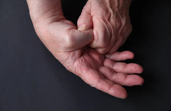 Older Man Has Pain Thumb Joint — 스톡 사진