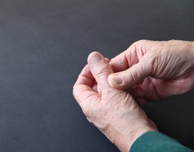 A man holds his painful thumb against a dark background with copy space