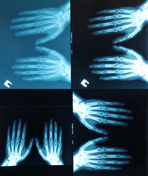 X-ray tarama — Stok fotoğraf