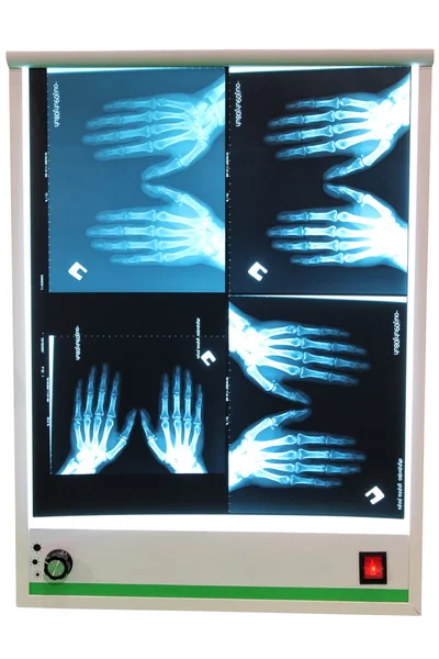 Fotografía de rayos X — Foto de Stock