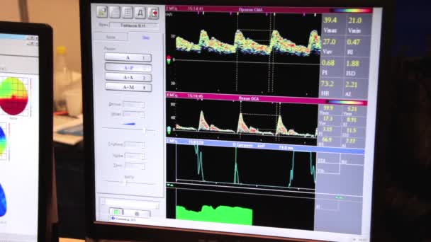 Diagramas no monitor — Vídeo de Stock