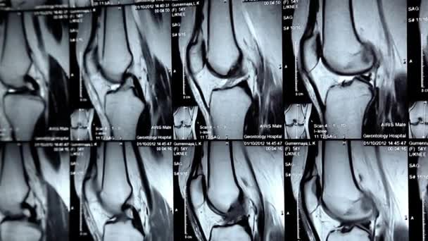 Imágenes de rayos X — Vídeo de stock