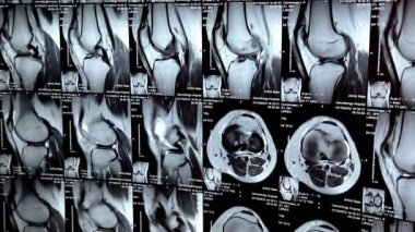 x-ışını resimleri