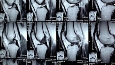 x-ışını resimleri