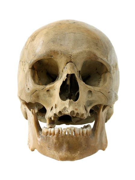 pics Toddler Skull Real 1 508 real human skull stock photos