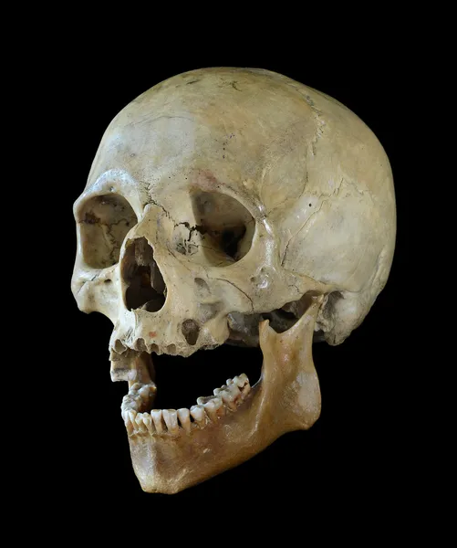 Human skull. — Stock Photo, Image