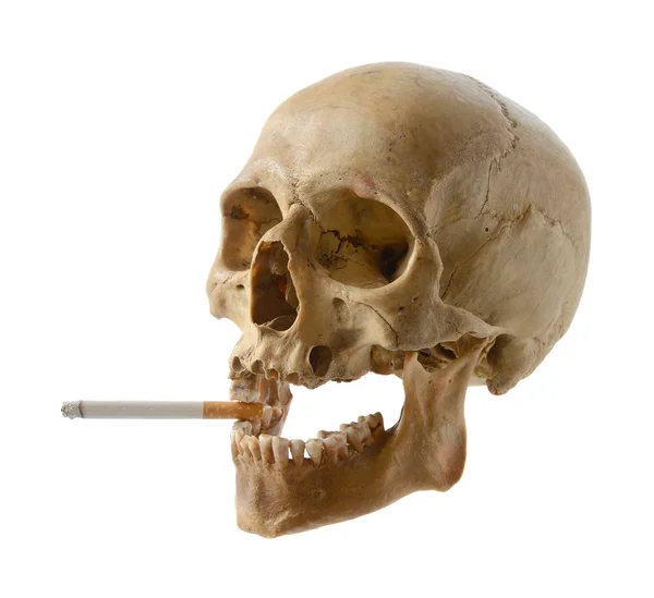 Crânio da pessoa com um cigarro . — Fotografia de Stock