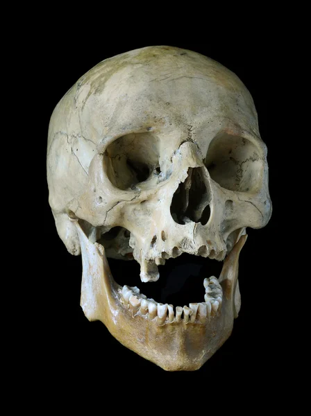 Old skull. — Stock Photo, Image