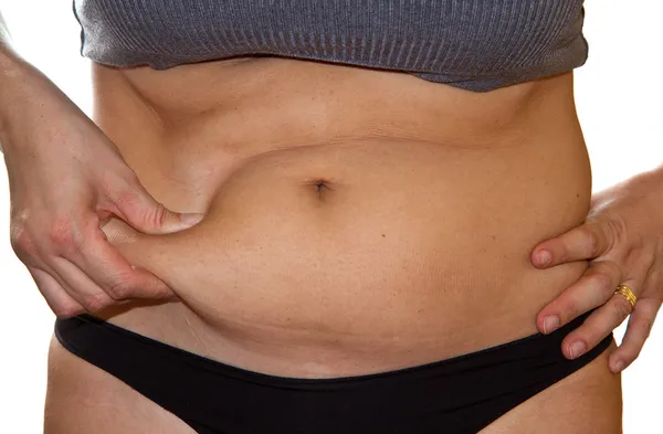 Woman's fingers measuring her belly fat — Stock Photo, Image