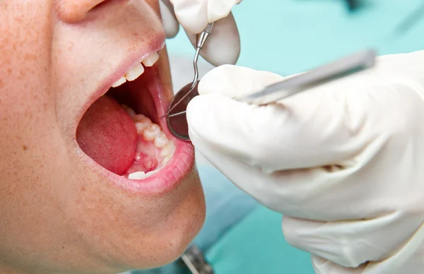 Fiatal nőstény fogainak vizsgálata — Stock Fotó