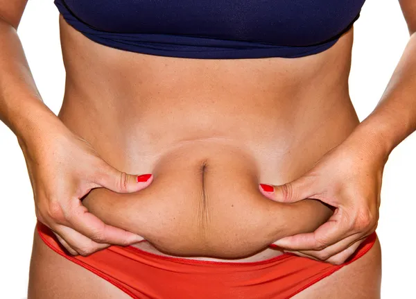 Woman's fingers measuring her belly fat — Stock Photo, Image