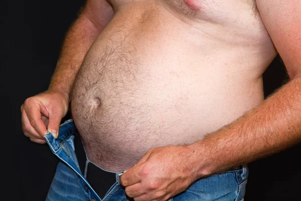 Um homem gordo com uma barriga grande. Dieta. — Fotografia de Stock