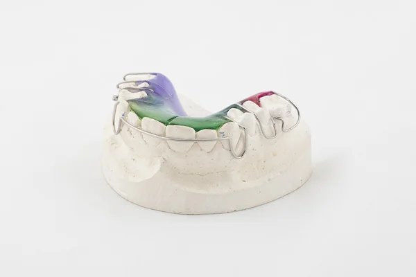 Piastra dentale — Foto Stock