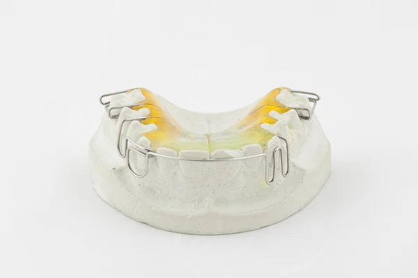 Dental plate — Stockfoto