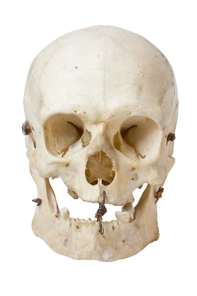 Craniu pe alb — Fotografie, imagine de stoc