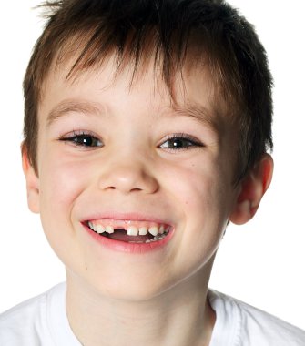 Toothless boy